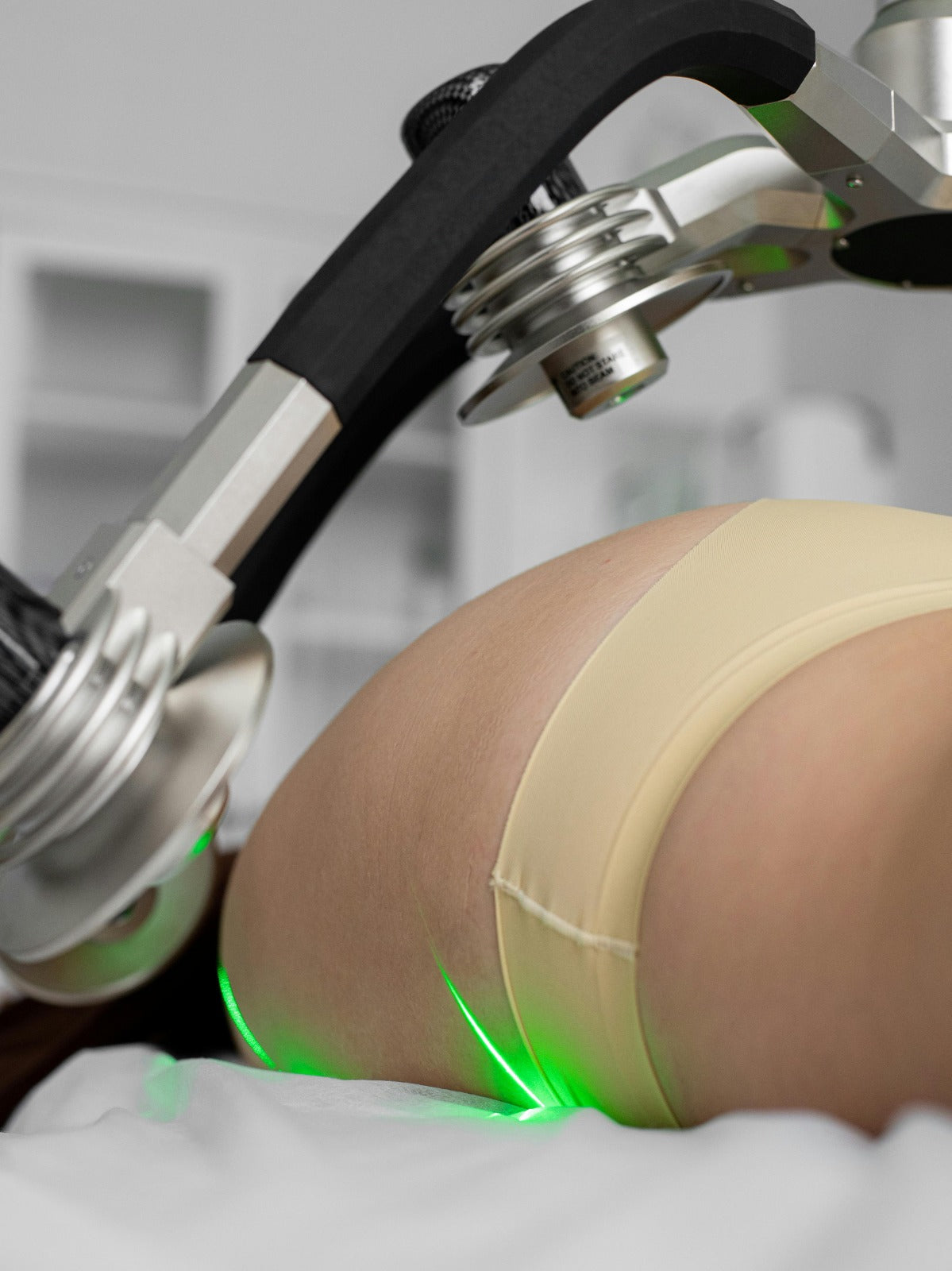 Buttocks Laser Hair Removal – 8 Sessions