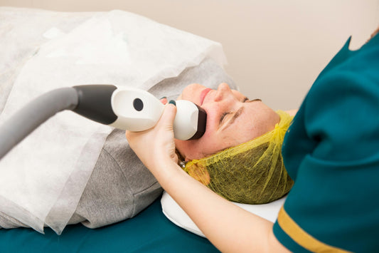 Diode Laser Full Face – 10 Sessions