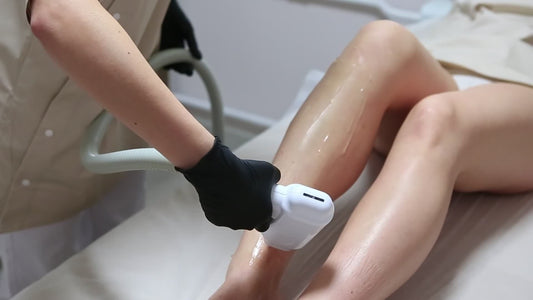 Diode Laser Lower Legs – 10 Sessions